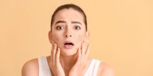 What Are the Best Tips for Reducing Acne and Breakouts?